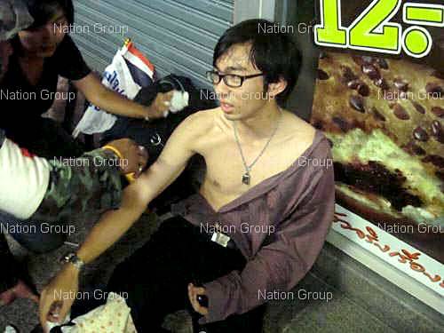 เพื่อนรุ่นน้องที่สนิทใน twitter โดนระเบิดในที่เกิดเหตุ เพื่อนรุ่นน้องที่สนิทใน twitter โดนระเบิดในที่เกิดเหตุ