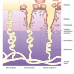 pre-eclampsia